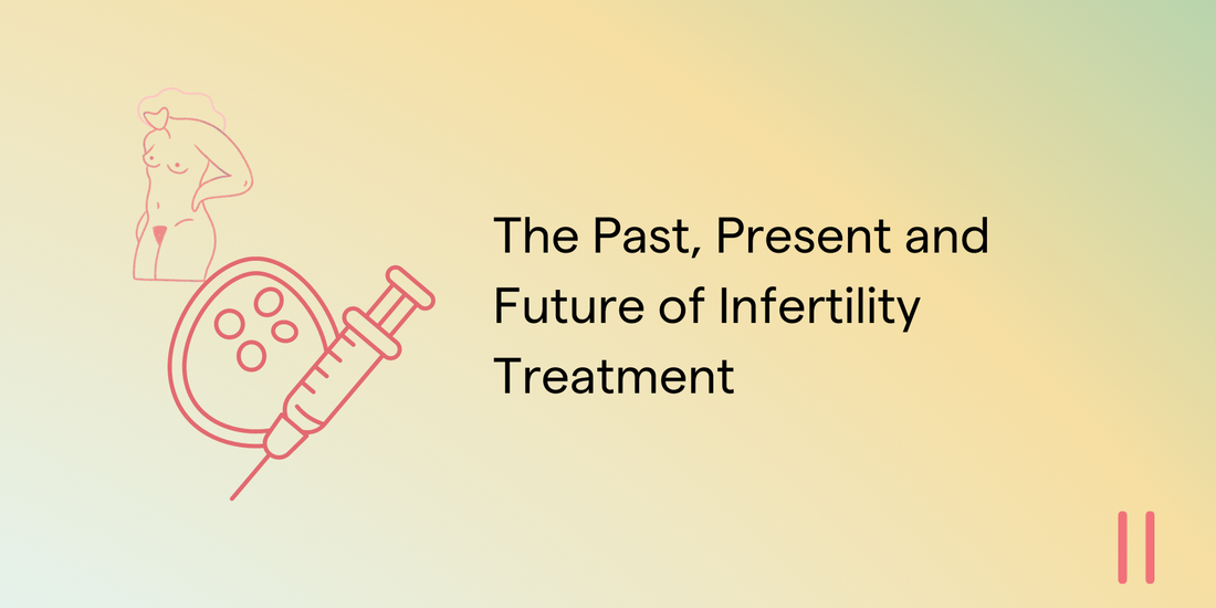 The Past, Present and Future of Infertility Treatment
